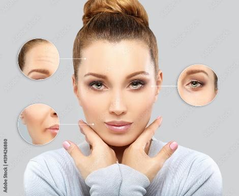 viso donna punti importanti dove applicare botox o filler