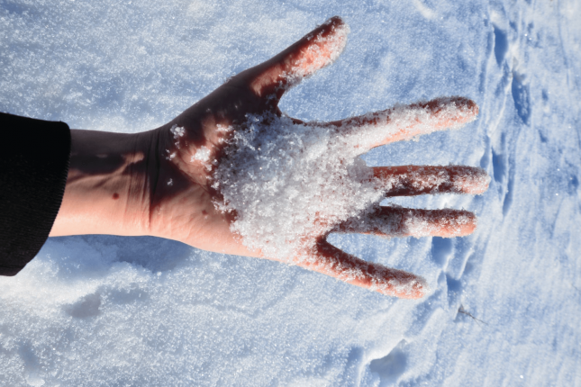 la pelle delle mani esposta al freddo è pià soggetta a eczema da freddo 