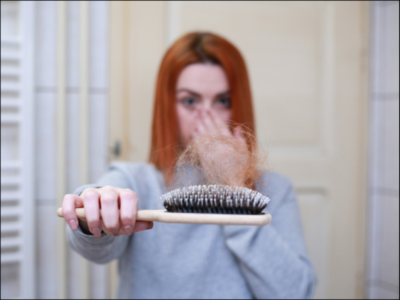 la caduta dei capelli nelle donne può essere causata da variazioni ormonali