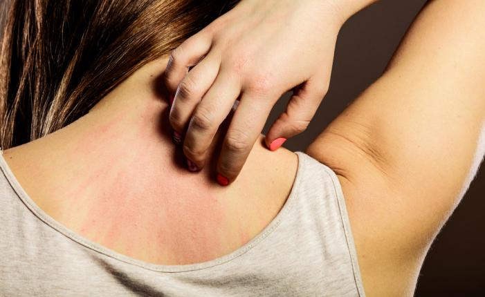 Visita dermatologica per allergie quando farla