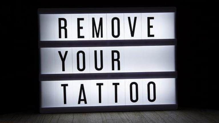 immagine 1 di Come Rimuovere un Tatuaggio Permanente