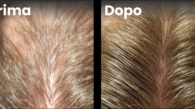immagine 7 di Quando e perché cadono i capelli