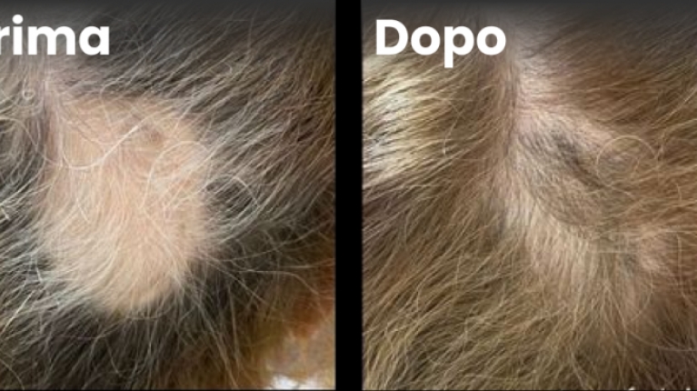 immagine 8 di Quando e perché cadono i capelli