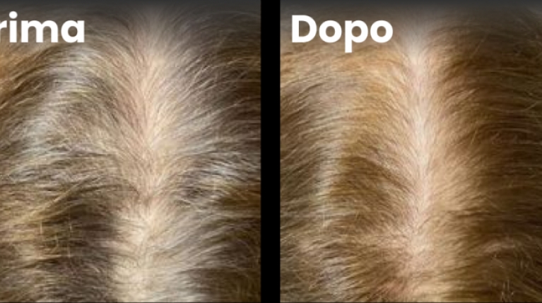 immagine 9 di Quando e perché cadono i capelli