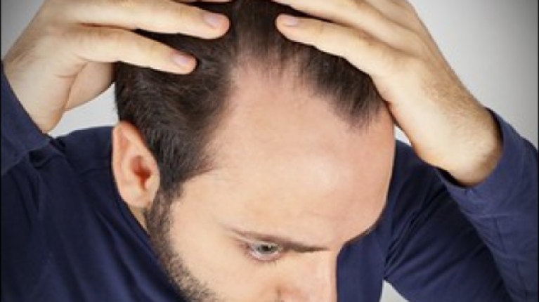 immagine 1 di Quando e perché cadono i capelli