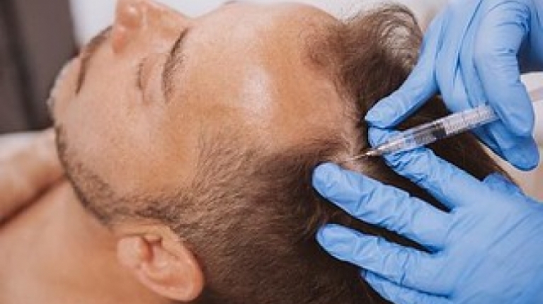 immagine 11 di Quando e perché cadono i capelli