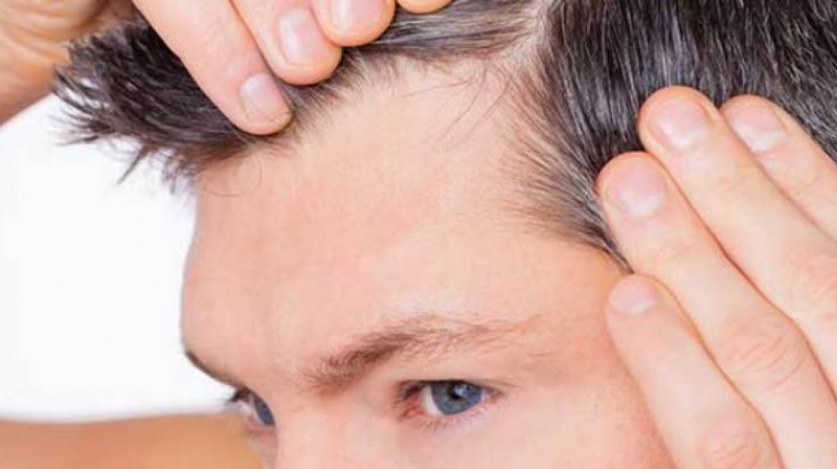 immagine 1 di Esame tricologico tra le visite di dermatologia in provincia di Trapani
