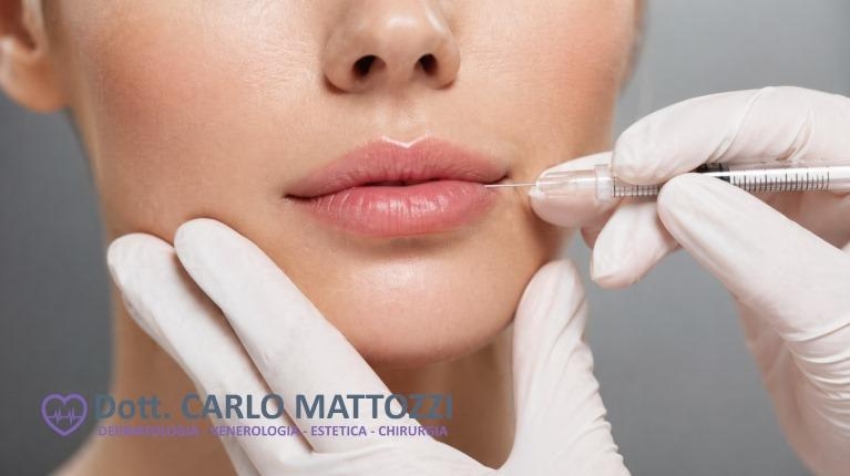 immagine 1 di Filler labbra? Scopri in cosa consiste e se può essere adatto a te