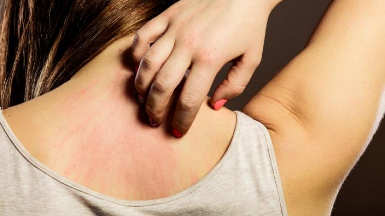 immagine 1 di Visita dermatologica per allergie quando farla