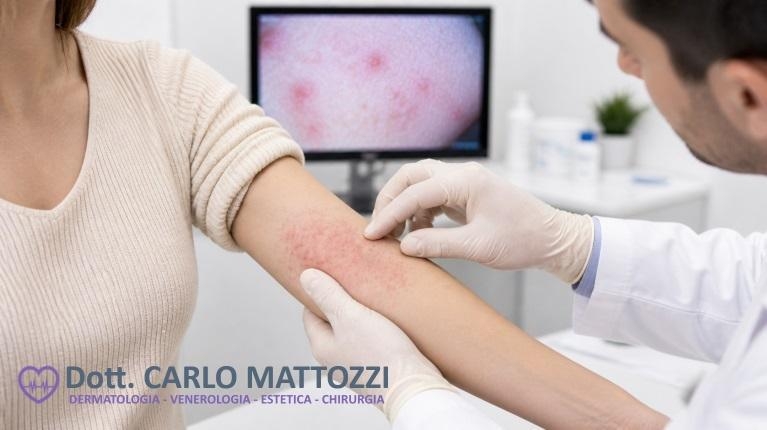 immagine 1 di Visita dermatologica per allergie quando farla