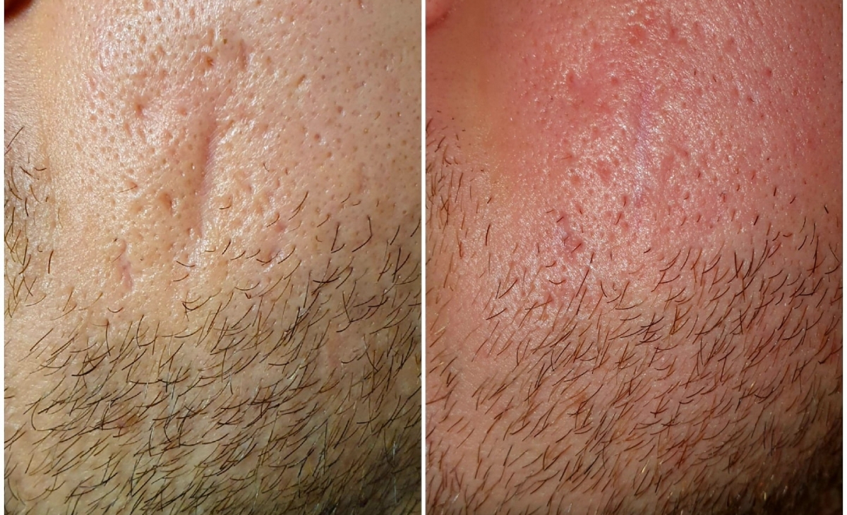 immagine 9 di Foto Trattamenti Estetici (prima e dopo)