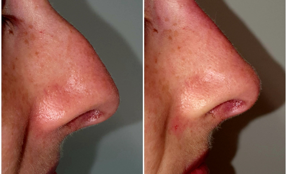 immagine 19 di Foto Trattamenti Estetici (prima e dopo)