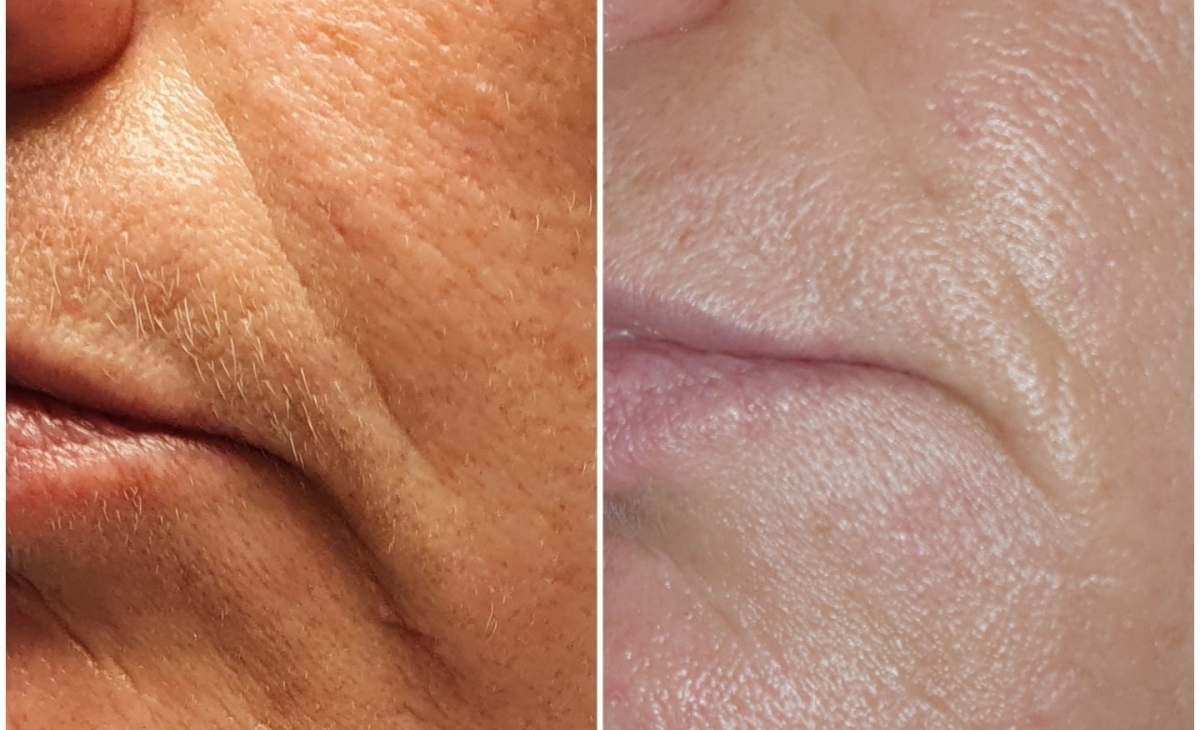 immagine 25 di Foto Trattamenti Estetici (prima e dopo)