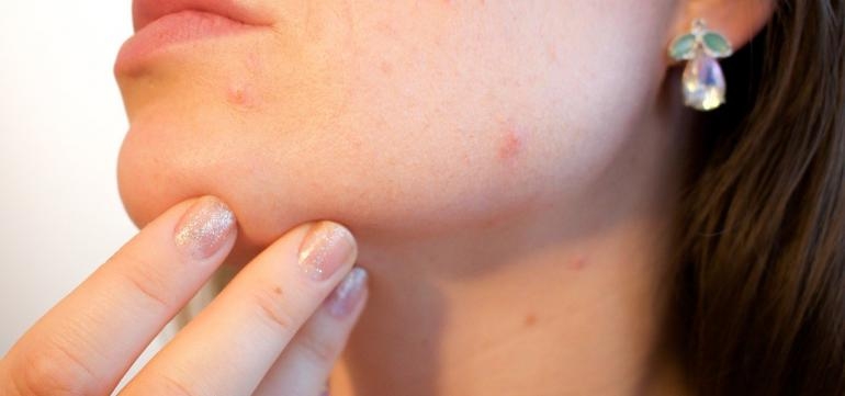 immagine 2 di Dermatologia